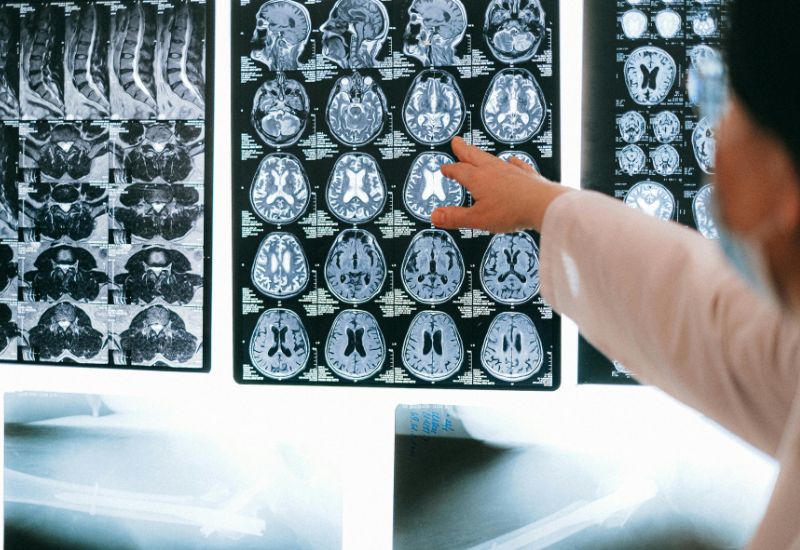 traumatic brain injury lawyers